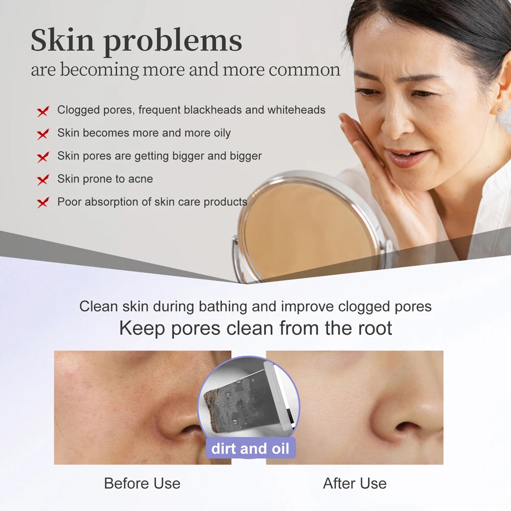 Depurador Facial Ultrasónico ANLAN - Limpieza de Poros, Terapia LED y EMS, IPX7
